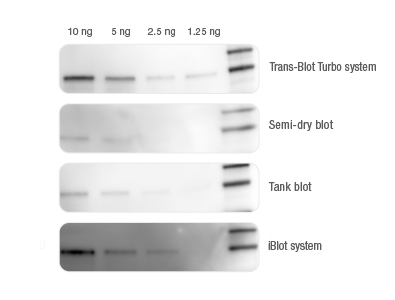 BIO-RAD Trans-Blot®Turbo美國伯樂全能型蛋白轉(zhuǎn)印系統(tǒng)1704150