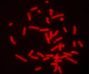 法國IMSTAR全自動熒光原位雜交軟件