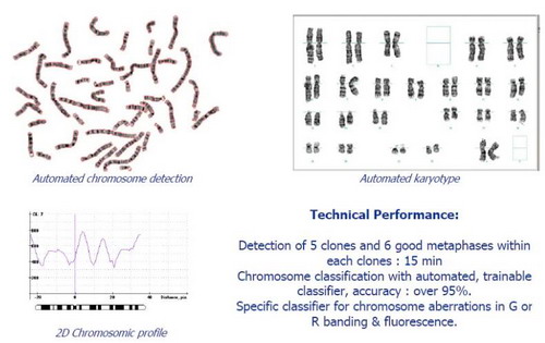 法國IMSTAR全自動熒光原位雜交掃描分析軟件,FISH熒光原位雜交系統