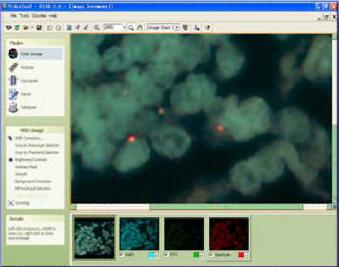 美國NVT熒光原位雜交FISH分析系統