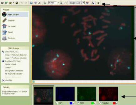 美國NVT熒光原位雜交FISH系統